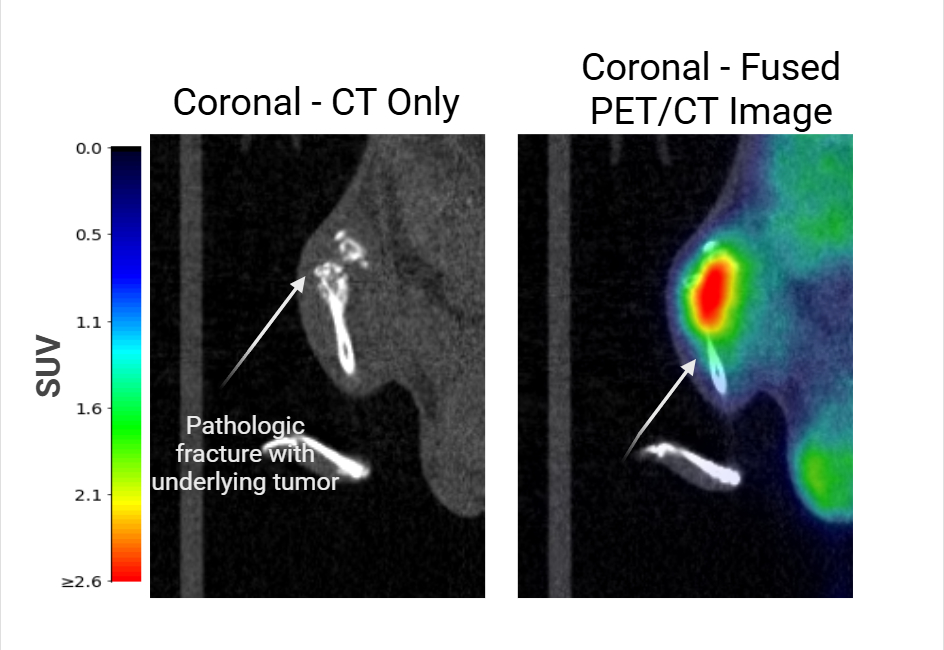 eHSP90-Targeted Theranostic PET